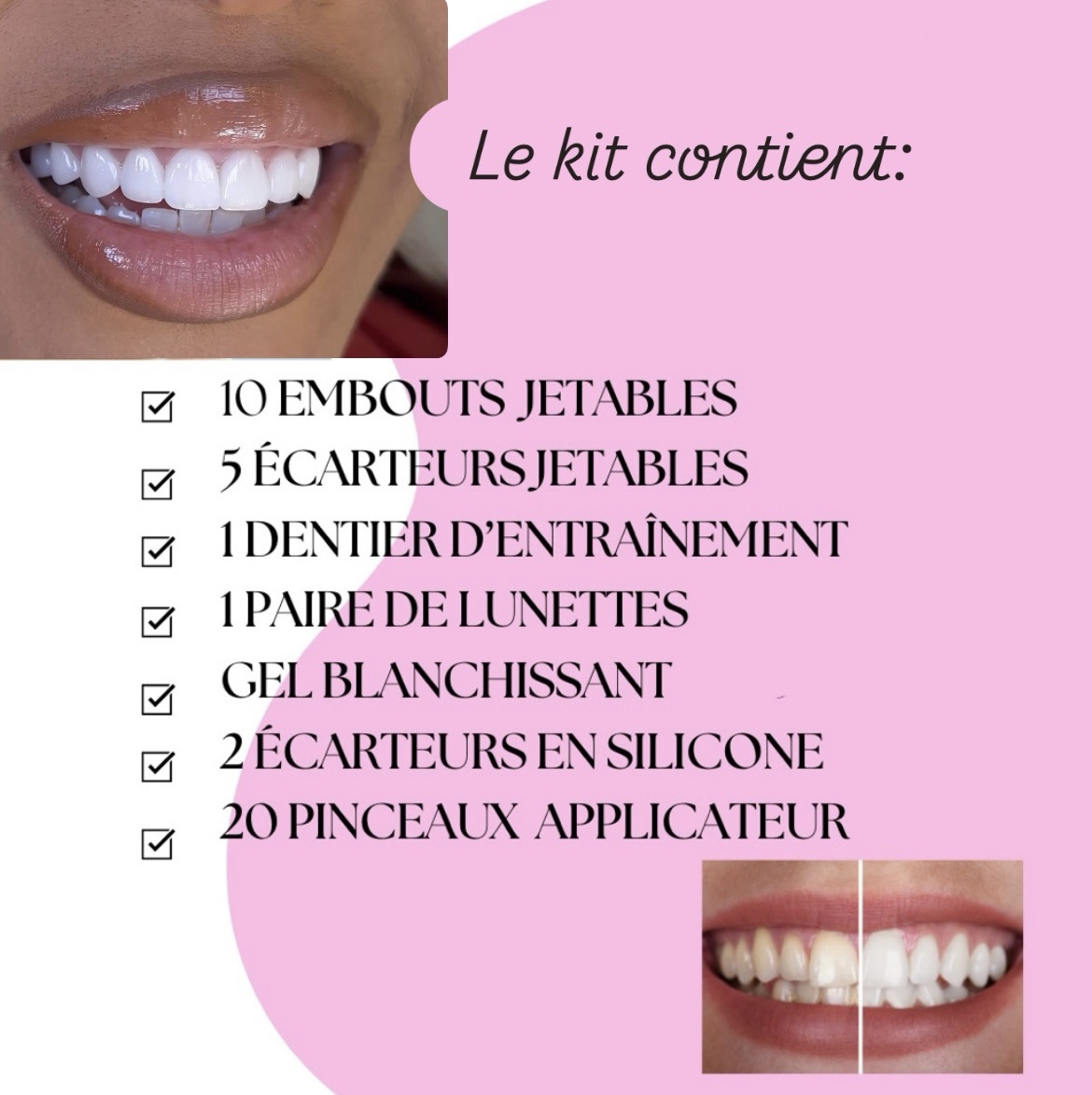 Formation blanchiment dentaire + kit inclus ( à distance) – Image 2